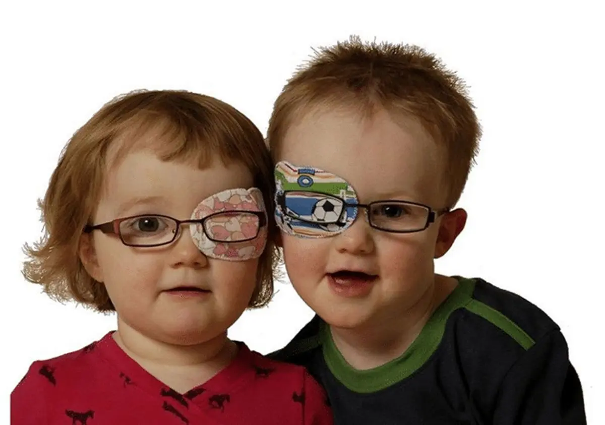خبری خوب برای کودکان مبتلا به تنبلی چشم