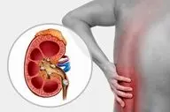 چه چیزهایی باعث سنگ ساز شدن کلیه ها می شود؟