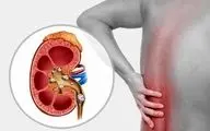چه چیزهایی باعث سنگ ساز شدن کلیه ها می شود؟