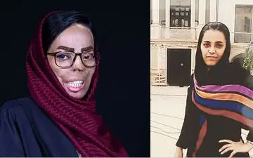 
عروسی که خواهر شوهرش را در حمله اسیدی سوزاند /او همچنان انکار می کند!