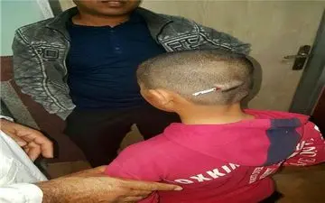 در رودبار کرمان اتفاق افتاد؛

فرو کردن مداد در سر دانش آموز توسط معلم