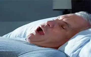 خروپف و خطر بروز سکته مغزی