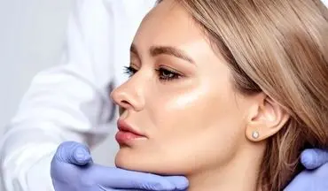 عمل لیفت گونه چیست و چه فرقی با لیفت صورت دارد؟