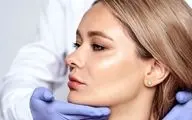 عمل لیفت گونه چیست و چه فرقی با لیفت صورت دارد؟