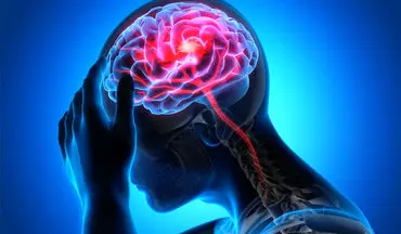 مراجعه سریع به بیمارستان کلید درمان مؤثر سکته مغزی است