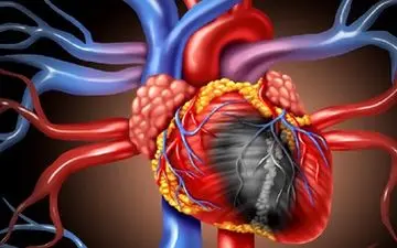 نشانه‌های اولیه بیماری چربی قلب را بشناسید