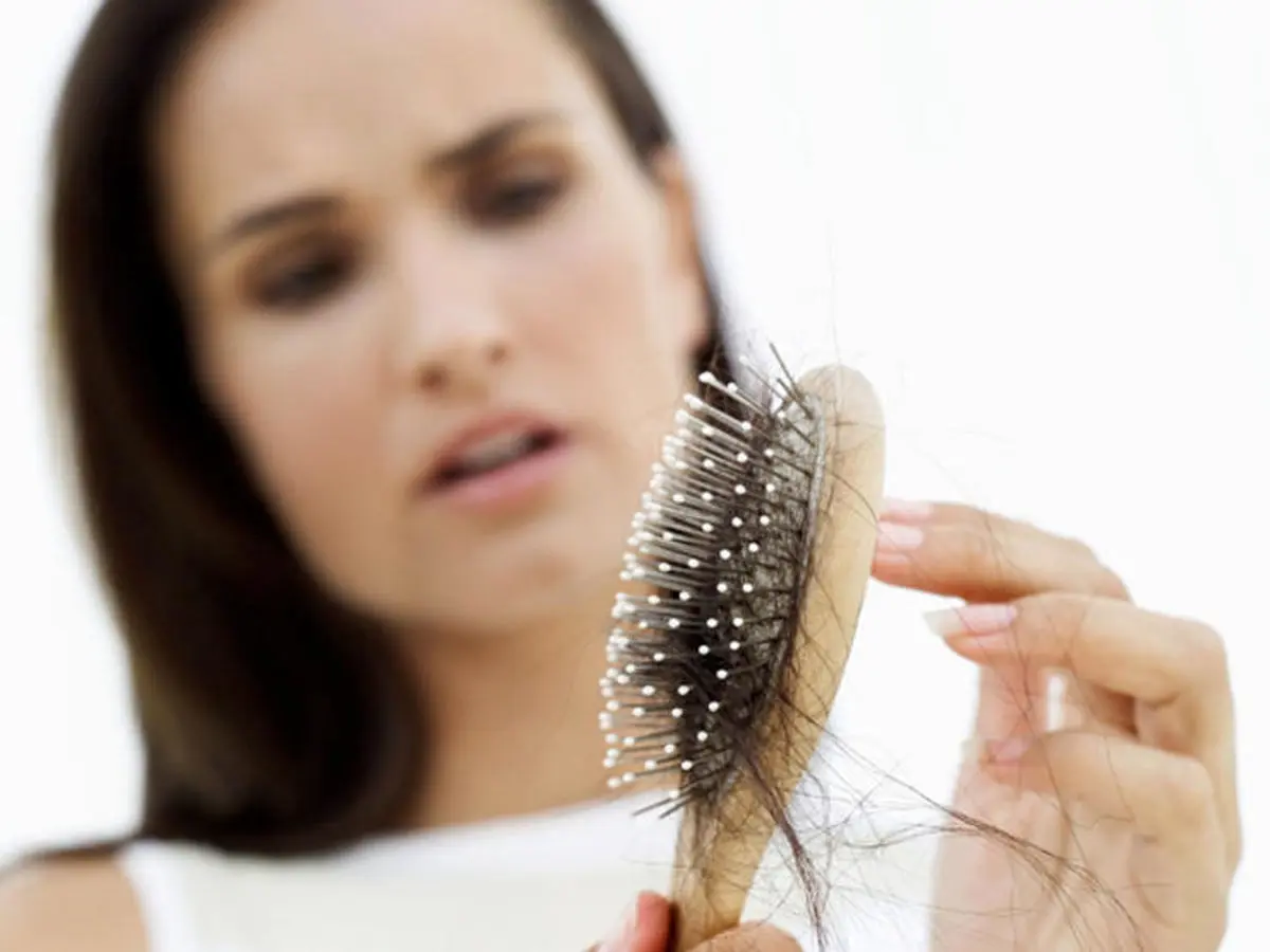درمان موهای نازک شده/ راهکارهایی برای پیشگیری از ریزش مو