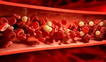 ترفندی برای پیشگیری از چربی خون