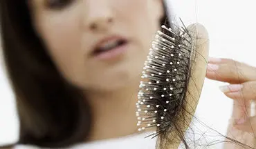 ریزش مو در اثر عوارض مصرف دارو در فاز تلوژن