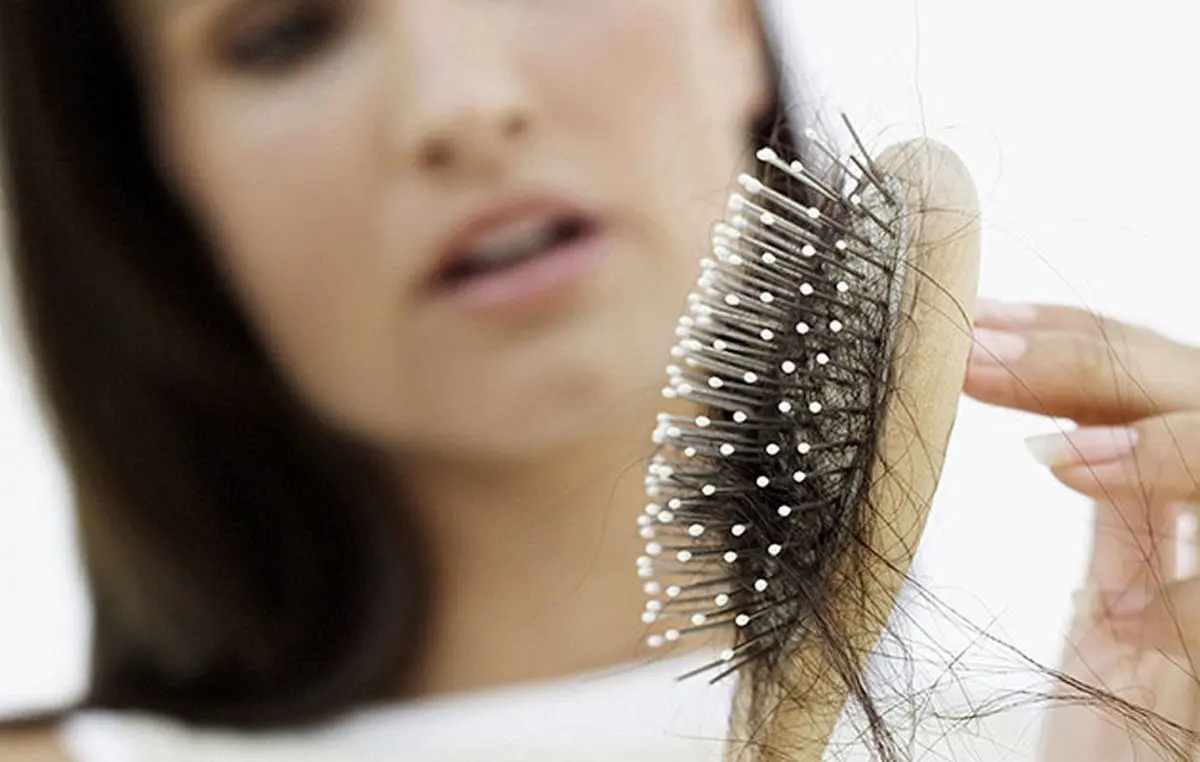 ریزش مو در اثر عوارض مصرف دارو در فاز تلوژن