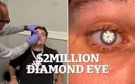 چشم مصنوعی با الماس ۲ قیراطی مردی که شبیه شرورهای جیمز باند است!