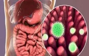 
انتقال کرونا از طریق دستگاه گوارش ممکن است؟
