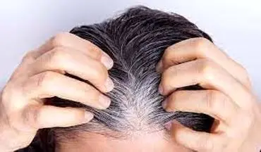 روش هایی آسان برای جلوگیری از سفید شدن مو