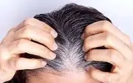 روش هایی آسان برای جلوگیری از سفید شدن مو