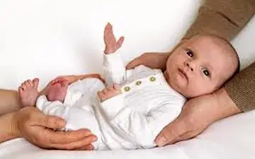 علائم و نشانه‌های هیپرکلسمی در نوزادان