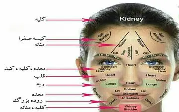 با آکنه های ناشی از مشکلات گوارشی چه کنیم؟