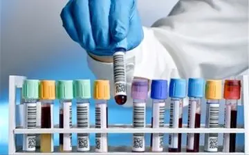 توانایی ایران درتأمین کامل داروی فاکتور9 از پلاسمای داخلی