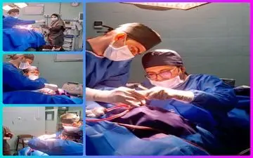 انجام نخستین عمل جراحی تمپانوپلاستی در بیمارستان امام خمینی (ره) اسلام‌آبادغرب