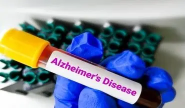 پیاده‌ روی روزانه آلزایمر را مهار می کند؟