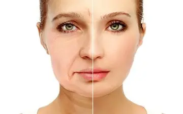 ترفندهای ساده و موثر برای جلوگیری از افتادگی پوست پس از کاهش وزن
