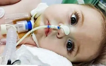 ازدواج فامیلی و بیماری «اس ام آ»