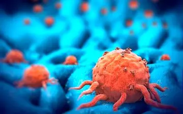 خطر ابتلا به سرطان بیخ گوش آقایان است!