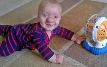 این کودک پینوکیوی واقعی است/عکس