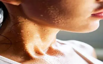 توصیه‌های متخصصان برای جلوگیری از تعریق بیش‌از‌حد؛ از بوتاکس تا امواج مایکروویو و جراحی
