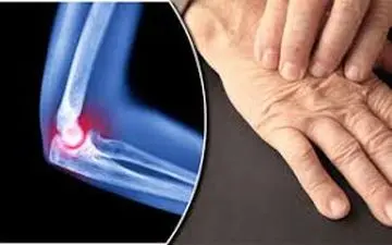 تاثیر رژیم غذایی گیاهی در تسکین علائم روماتیسم مفصلی