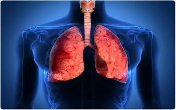 کسانی که دندان مصنوعی دارند ذات الریه می گیرند؟