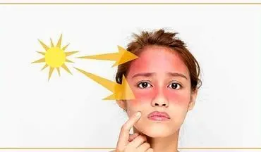 ریسک آفتاب سوختگی با مصرف این نوع داروها بیشتر می شود
