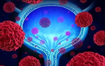 این اتفاق احتمال ابتلا به سرطان دهانه رحم را دو برابر می کند

