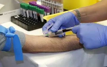 آزمایش موفقیت آمیز تشخیص'اسکلروز جانبی آمیوتروفیک'در ایتالیا