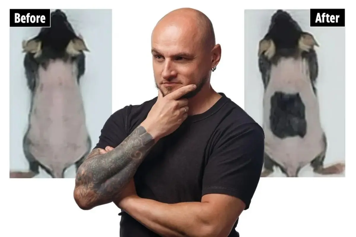 کشف باورنکردنی: درمان طاسی در کمتر از ۲۰ روز!