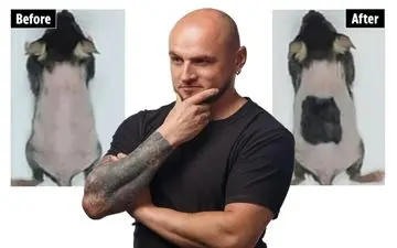 کشف باورنکردنی: درمان طاسی در کمتر از ۲۰ روز!