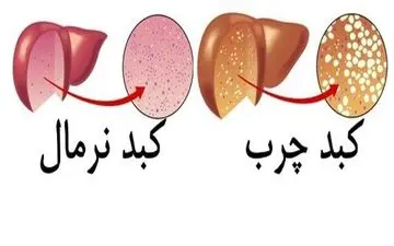 اگر نوزاد شیر مادر کافی نخورد به این بیماری دچار خواهد شد! 