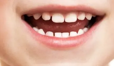 دانستنی‌های دندان شیری