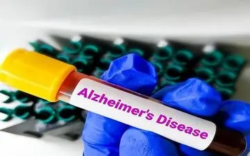 آلزایمر در کمین است/ ۴ مسیرِ کلیدی که باید از آن‌ها دوری کنید