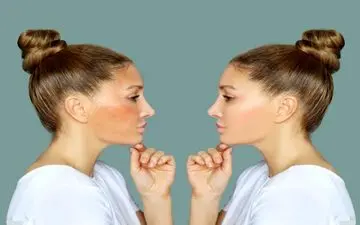 لکه های تیره پوست تان آزارتان می دهد؟ راه حلش اینجاست!
