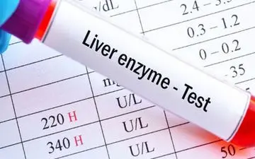 چطور برای آزمایش آنزیم های کبدی باید آماده شد؟