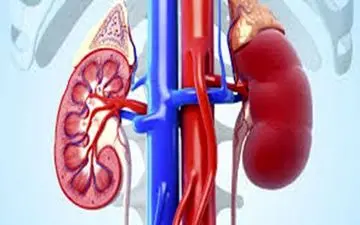 چه کسانی در معرض ابتلا به سنگ کلیه هستند؟