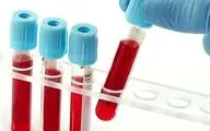 نکات آزمایش خون که پزشک به شما نمی گوید