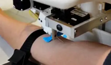رباتی هوشمند و دقیق برای نمونه گیری خون + فیلم 