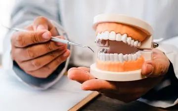 مراقبت های لازم پس از جراحی ریشه دندان