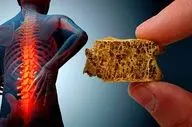 پایان پوکی استخوان؟ دانشمندان کلید ترمیم استخوان را پیدا کردند