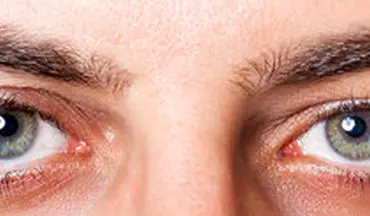  علت خشکی چشم چیست؟ + راهکارهای درمان آن