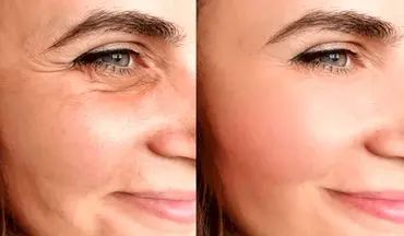  ۵ راهکار طلایی و موثر برای سفت شدن پوست صورت