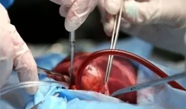 اعضای نوجوان ۱۷ ساله رامهرمزی به سه بیمار نیازمند اهدا شد