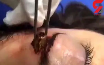 برخورد گلوله به صورت دختر 15 ساله +فیلم (+16)