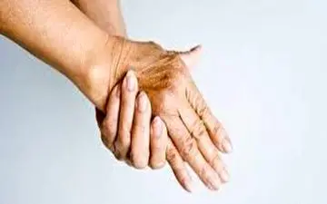 ۷ دلیل پیر شدن دست‌ها